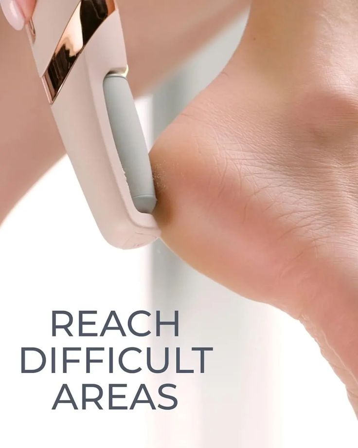Electric Foot Callus Remover β Rechargeable Pedicure File for Dead Skin, Cracked Heels & Smooth Feet