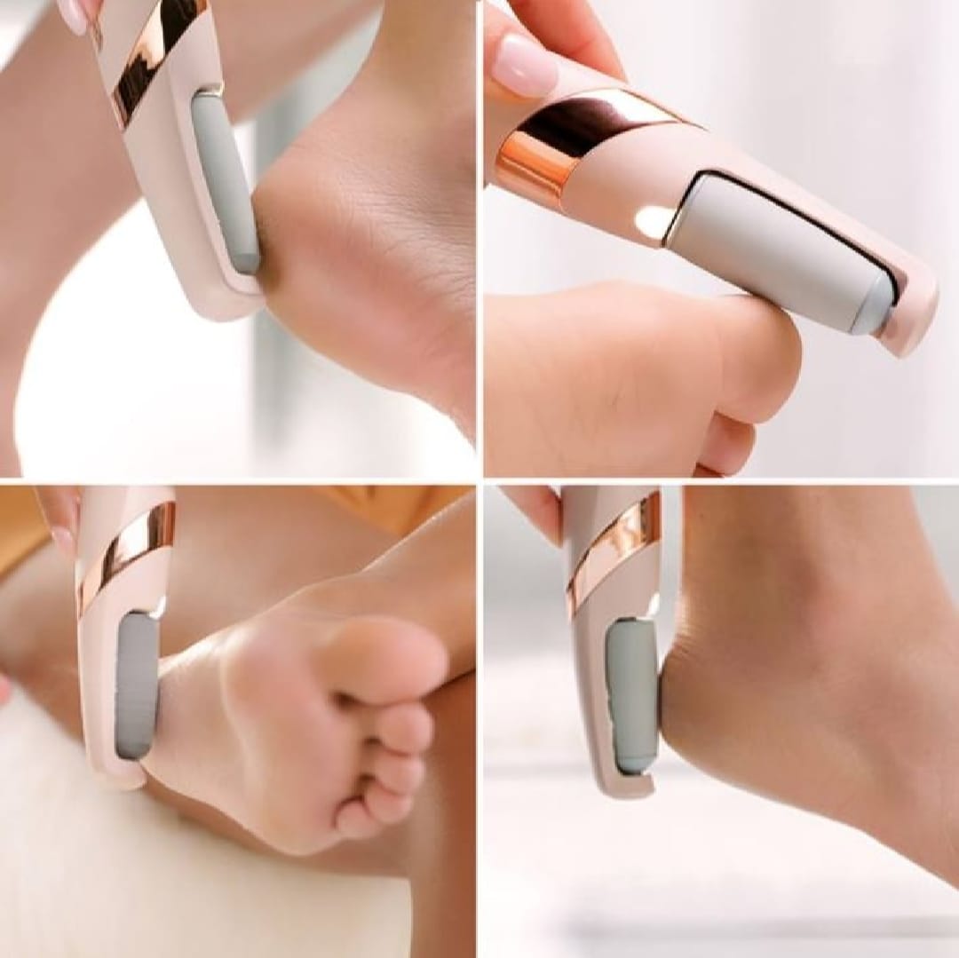 Electric Foot Callus Remover β Rechargeable Pedicure File for Dead Skin, Cracked Heels & Smooth Feet