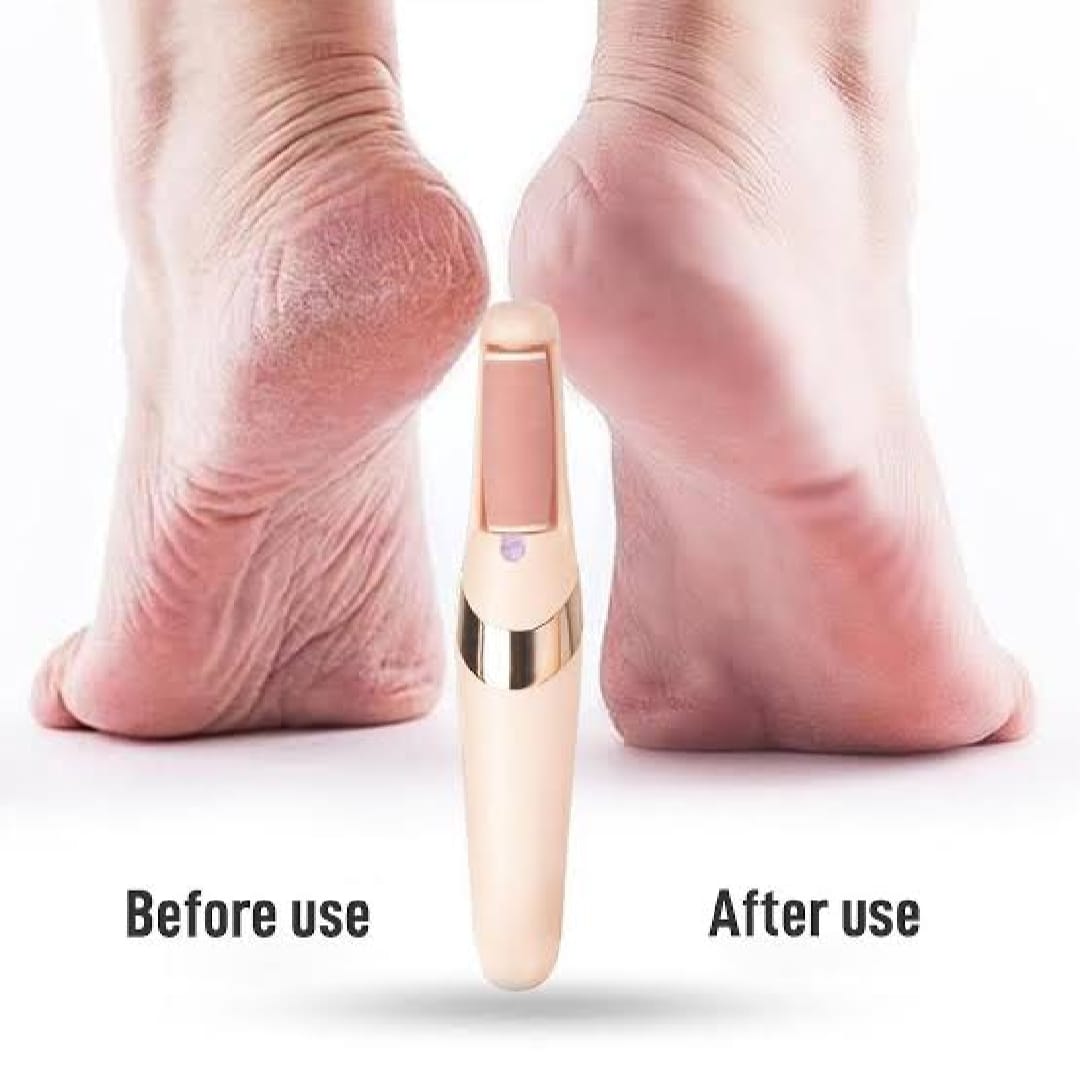 Electric Foot Callus Remover β Rechargeable Pedicure File for Dead Skin, Cracked Heels & Smooth Feet