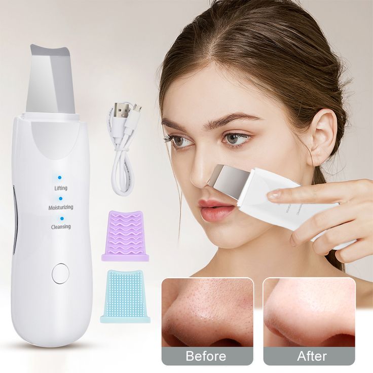 Ultrasonic Facial Skin Scrubber